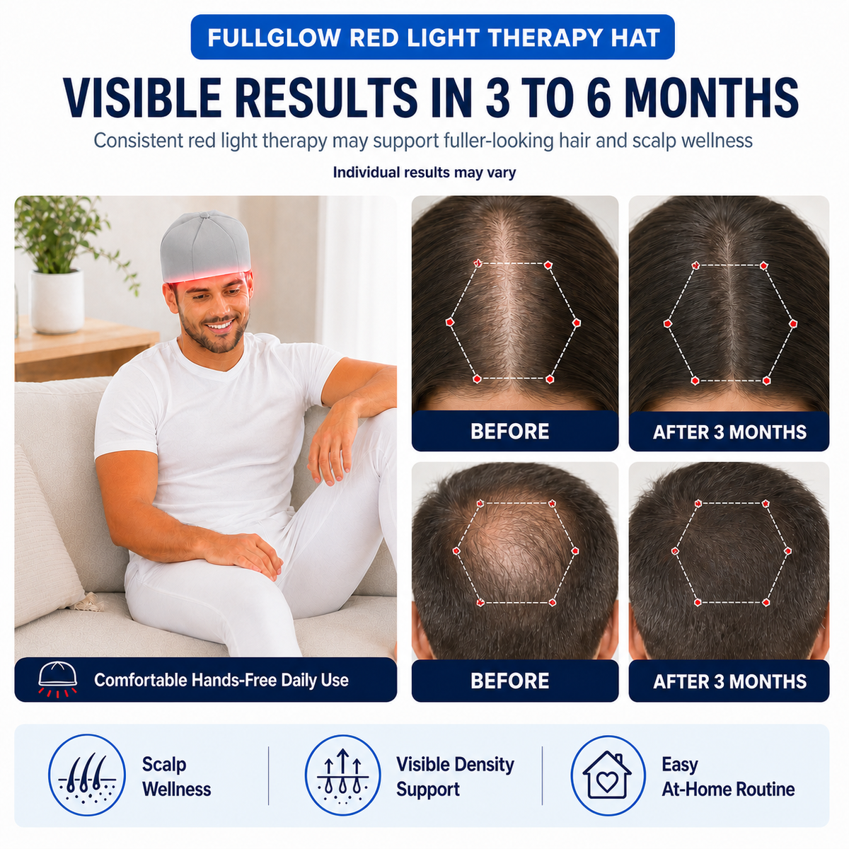 NEO LUMINUS Red Light & Infrared Therapy Hat