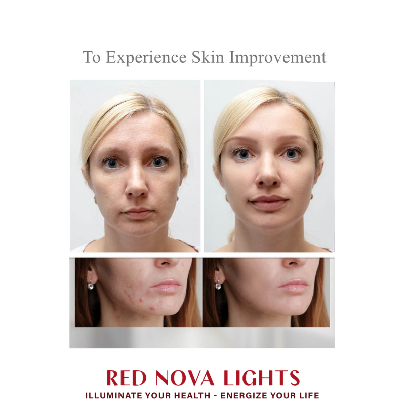 NEO LUMINUS LED Face Mask – Multi-Wavelength Light Therapy for Skin